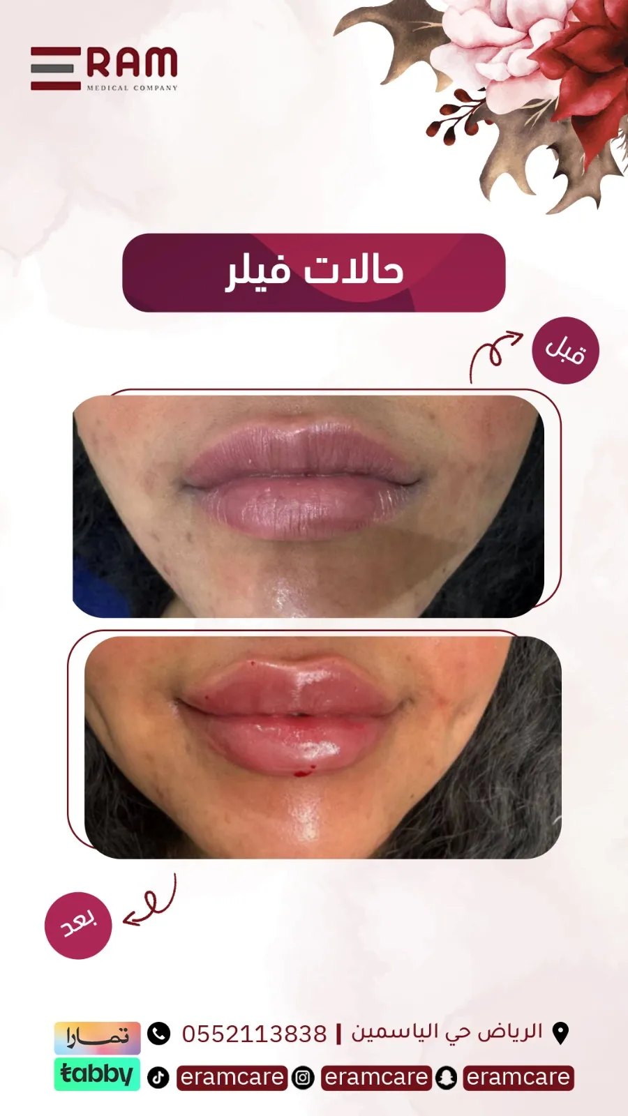 بعد تقويم - حالة 01